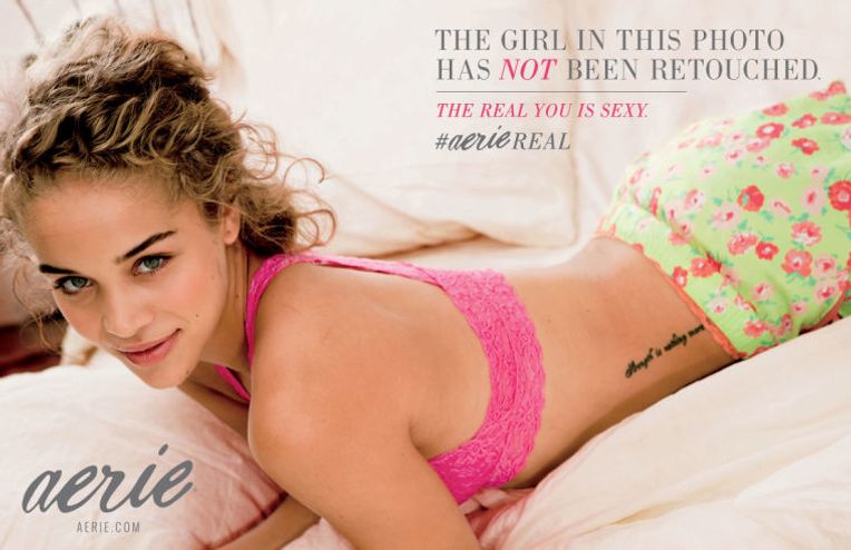 Aerie Continues Its 'Real' Streak, Casting Models With Illnesses