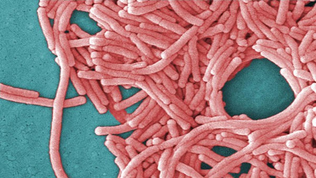 Everything You Need To Know About Legionnaires' Disease