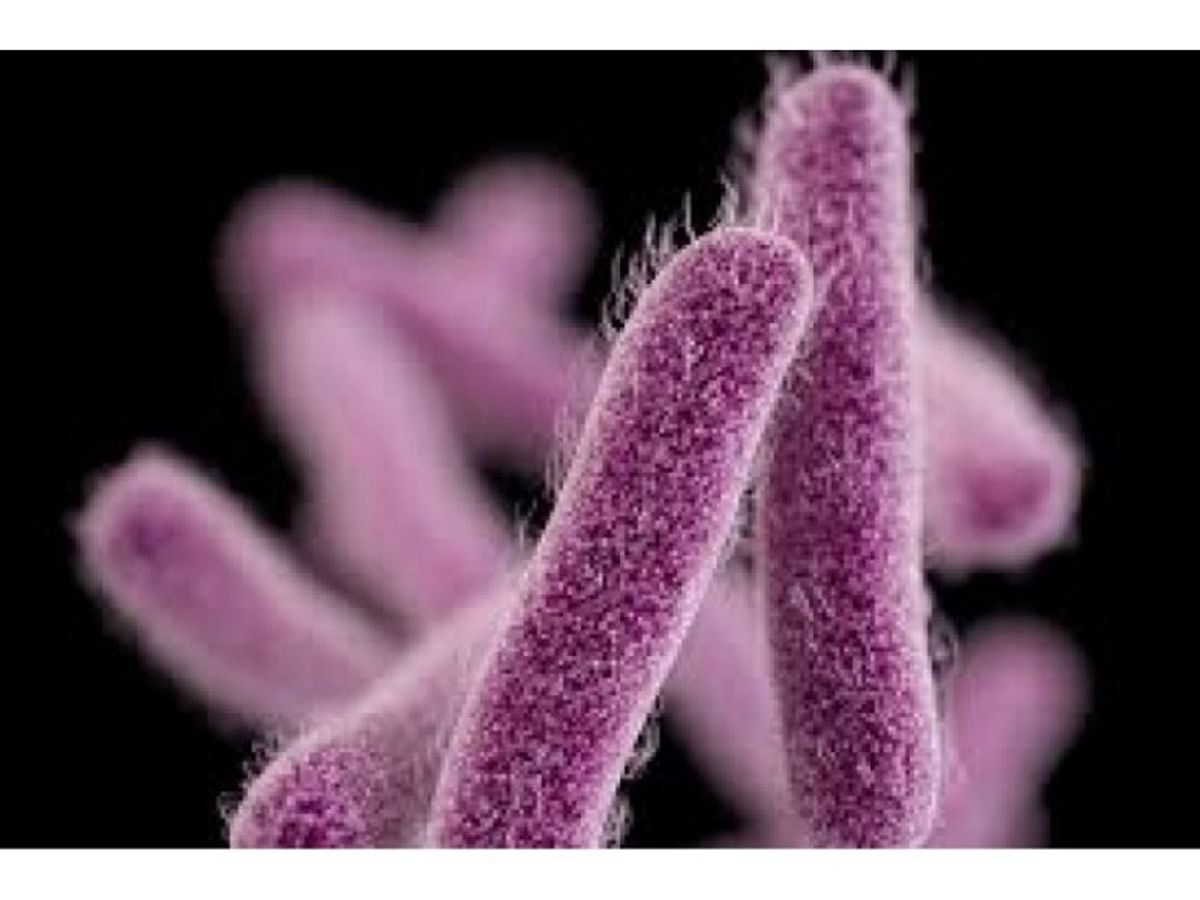 The Shigella Outbreak: What You Need To Know