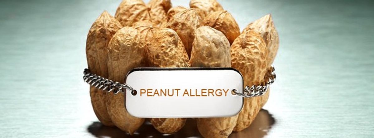 14 Struggles That Are Too Real For People With Peanut Allergies