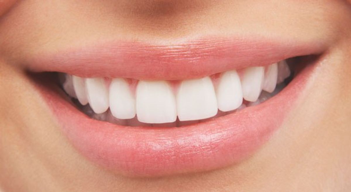 What It's Like To Have Less Than Perfect Teeth