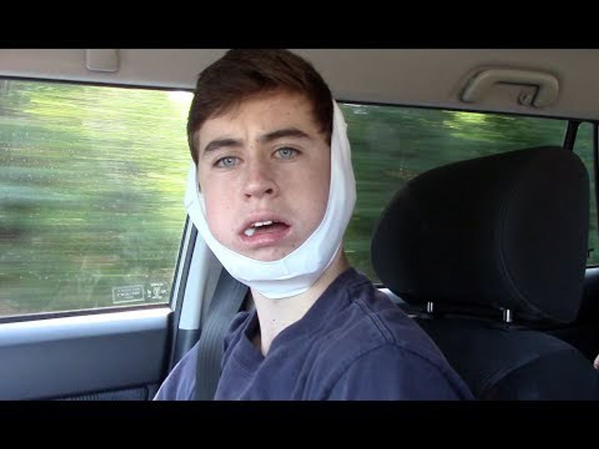 10 Best Wisdom Teeth Reaction Videos