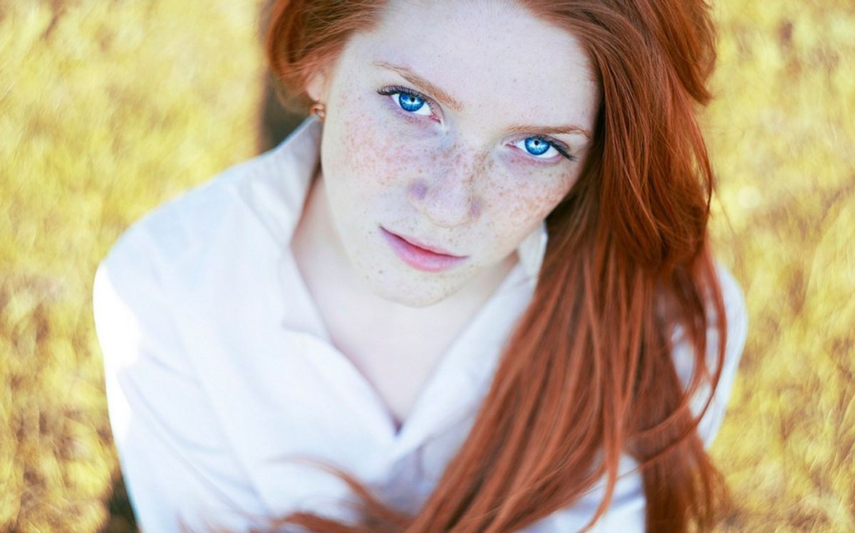 15 Struggles Of Being A Ginger