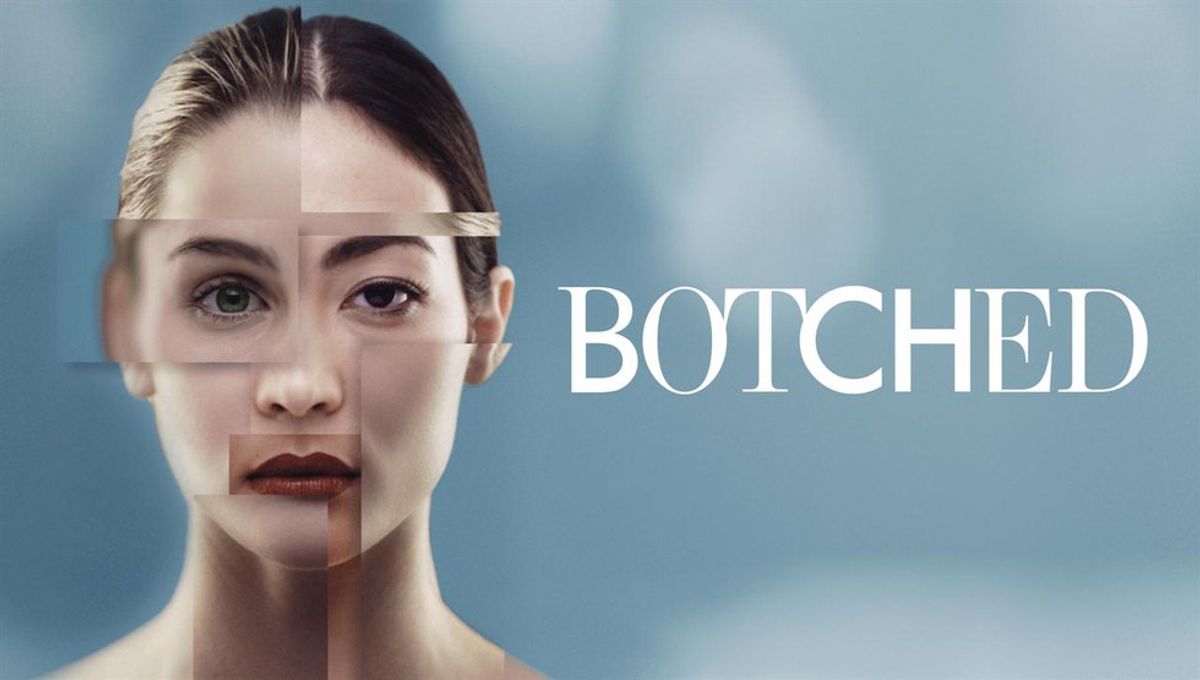 The Importance Of "Botched" In The Body Image Conversation