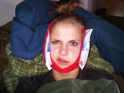 21 Yummy & Soft Foods To Eat After Wisdom Teeth Removal