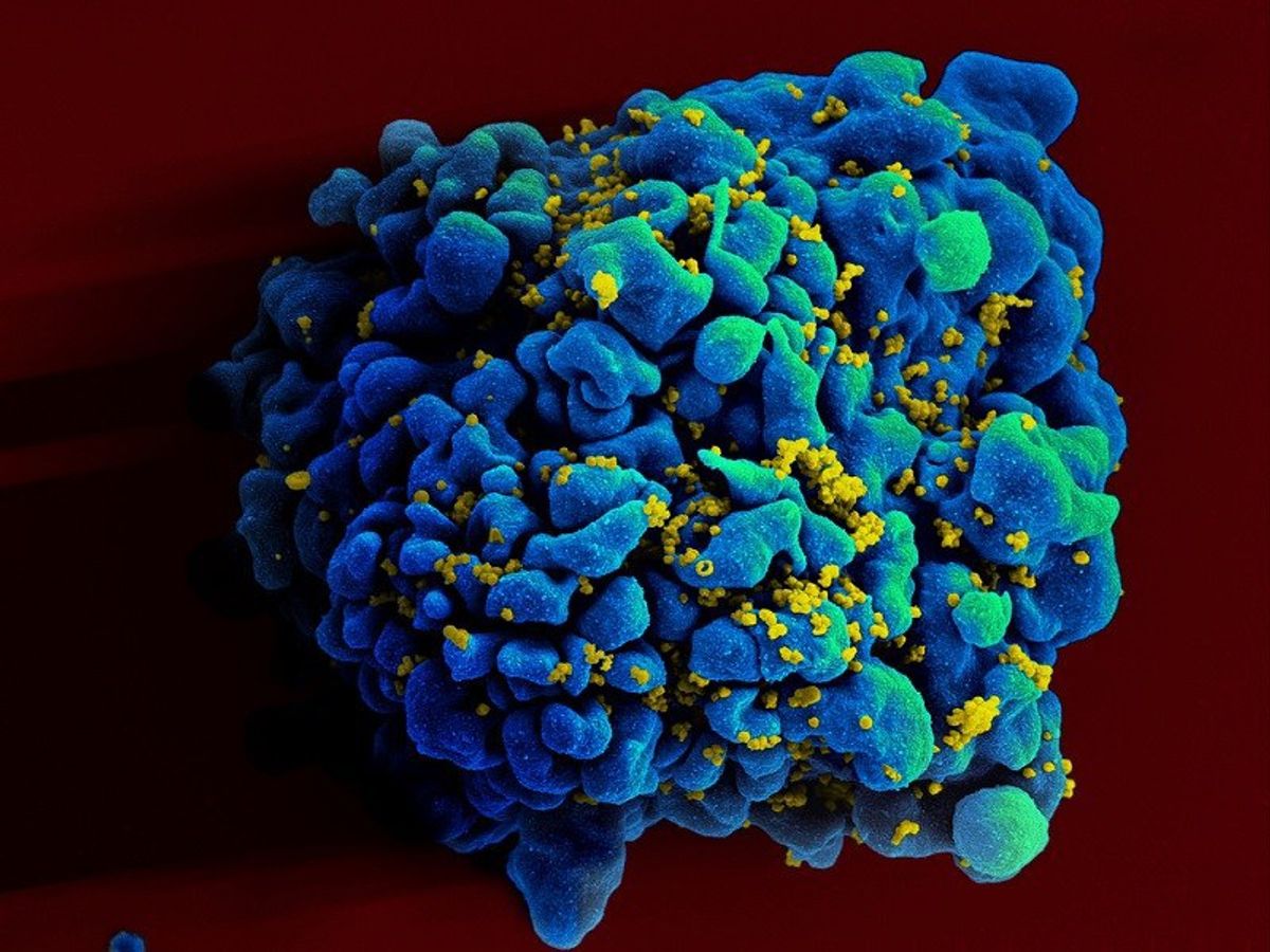 This Genetic Mutation Actually Leads To HIV Immunity