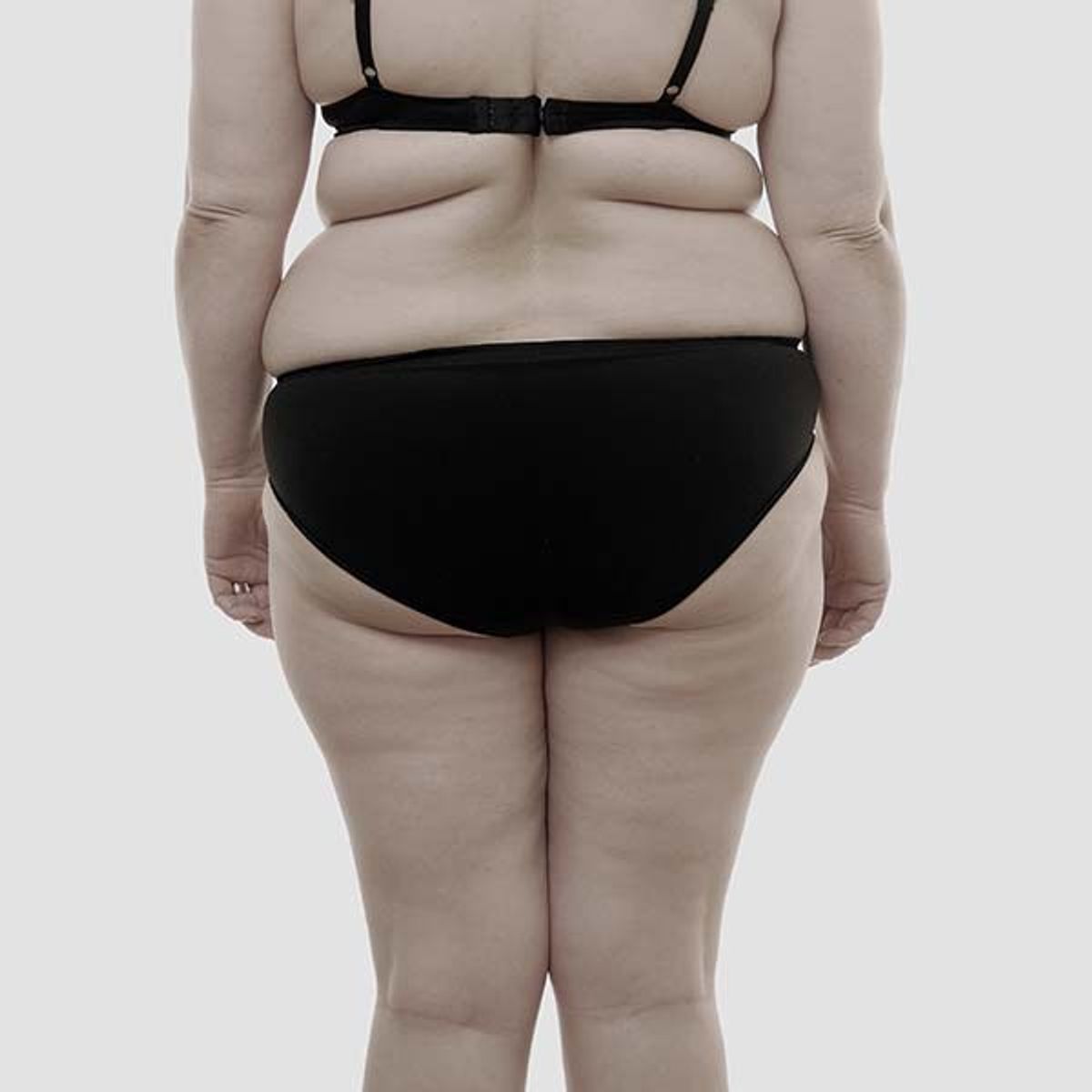 Should The Fat Acceptance Movement Be... Accepted?