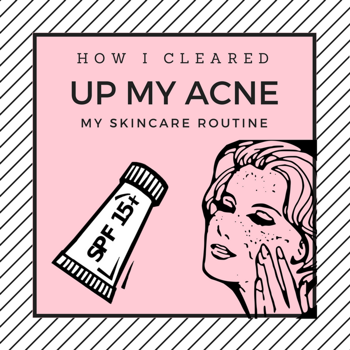 My Fight Against Acne