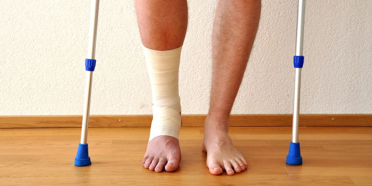 10 Things Only People Who Have Broken A Bone Know All Too Well