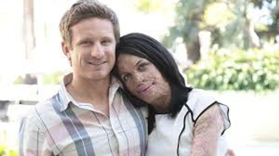 Turia Pitt And Michael Hoskins: What True Love Looks Like