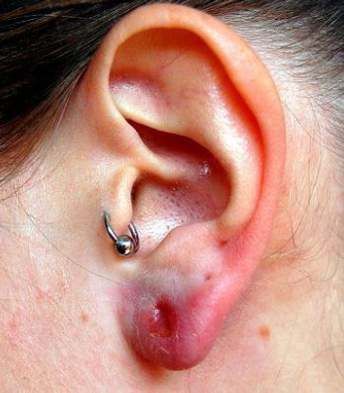 An Introduction To: Cartilage Piercings - Rogue Piercing