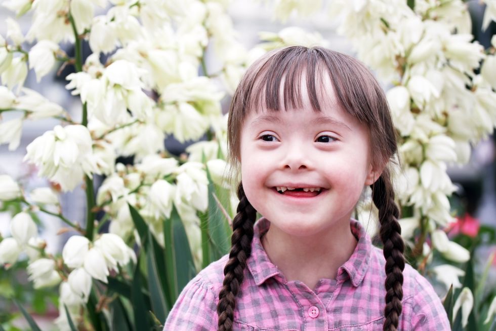 Why Is Down Syndrome Looked Down Upon?