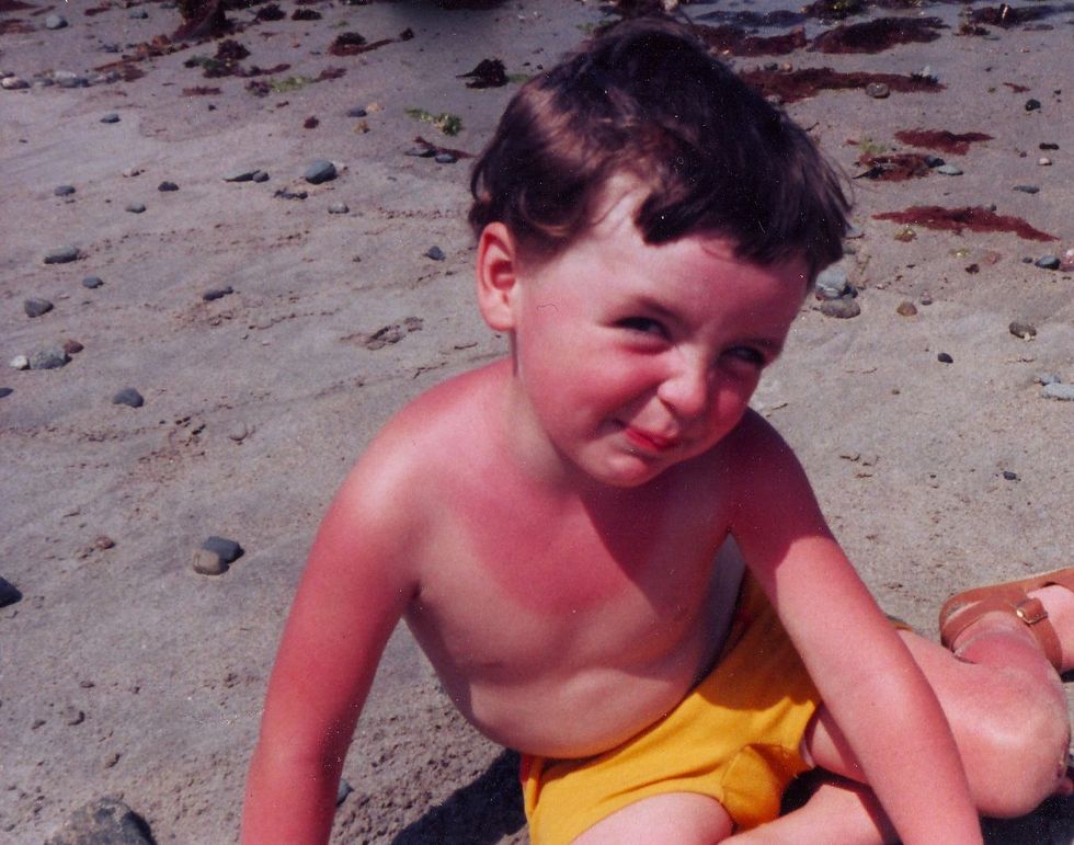 The 8 Stages Of The First Sunburn Of The Season