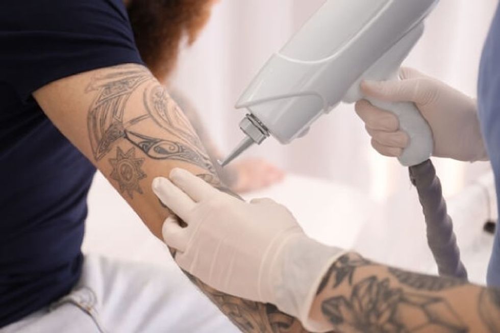 Why I Recommend To Work In Laser Tattoo Removal?