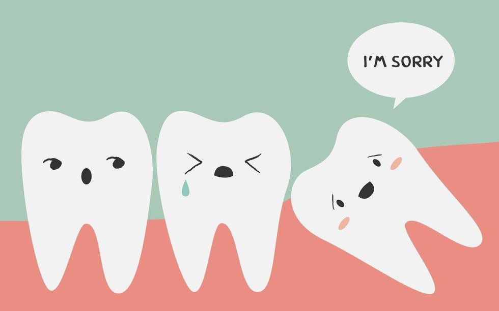 My Wisdom Teeth Story