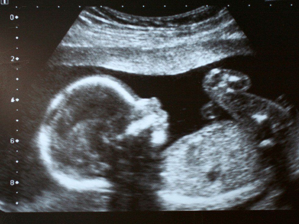 I Will Never Be Pro-Choice, But Pro-Life Has To Change