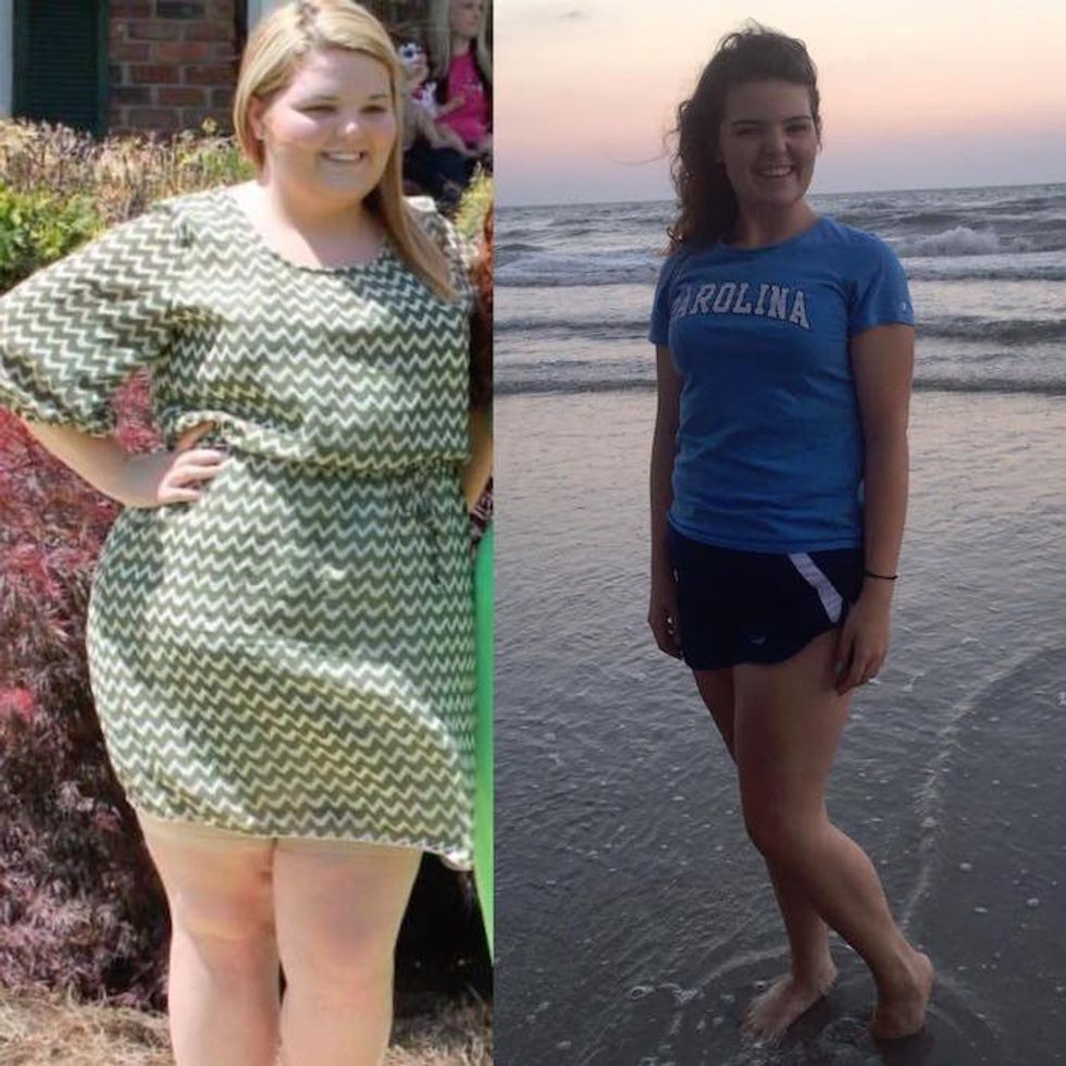 11 Things Weight Loss Surgery Patients Want You To Know