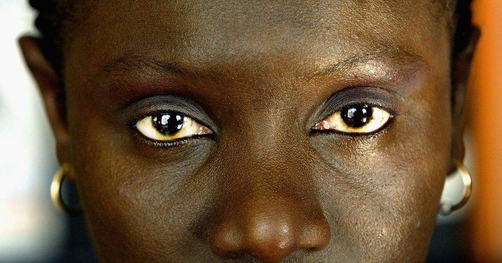 Female Genital Mutilation Has Been Banned In Nigeria