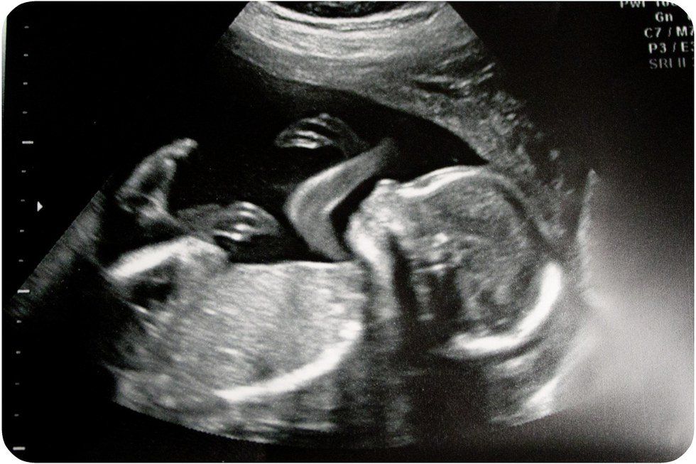 An Open Letter From An Unborn Child