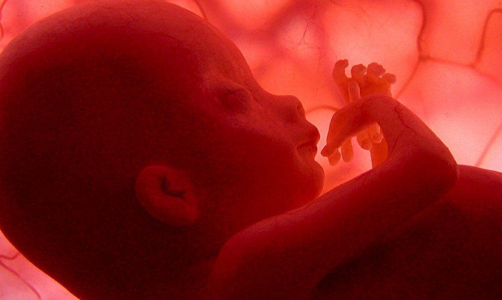 Dealing With The Unborn