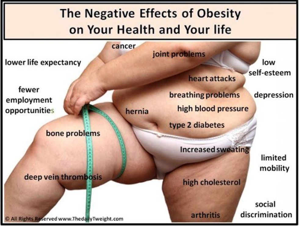 The Rise In Obesity Is Something We All Need To Talk About