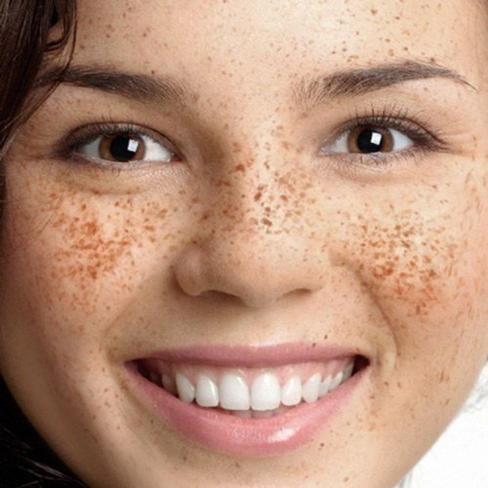 9 Things Every Freckle Faced Person Understands