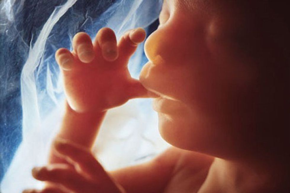 Why I Am Pro-Life