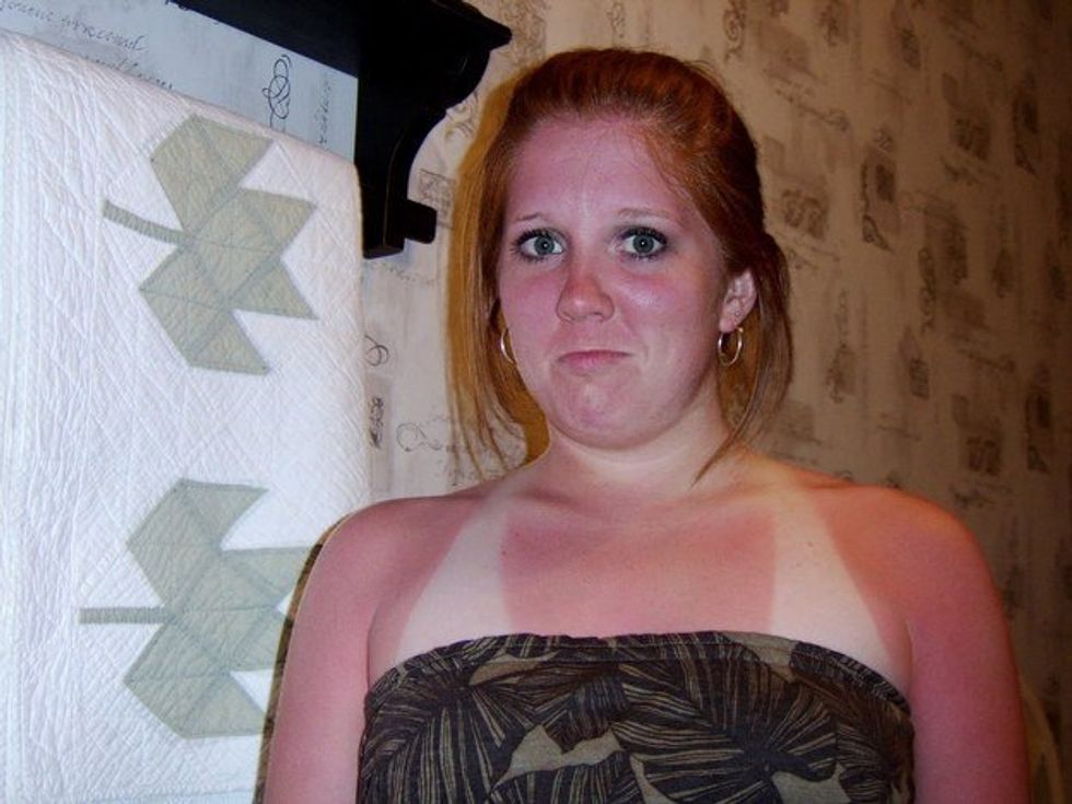 Tanning Tales From a Ginger