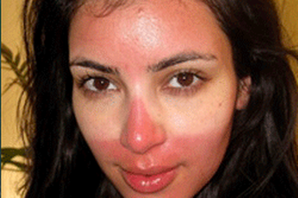 The 10 Stages Of A Sunburn