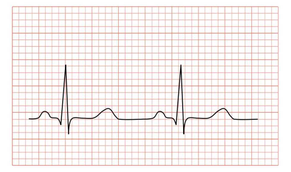 The Power of Modern ECG Analysis Software